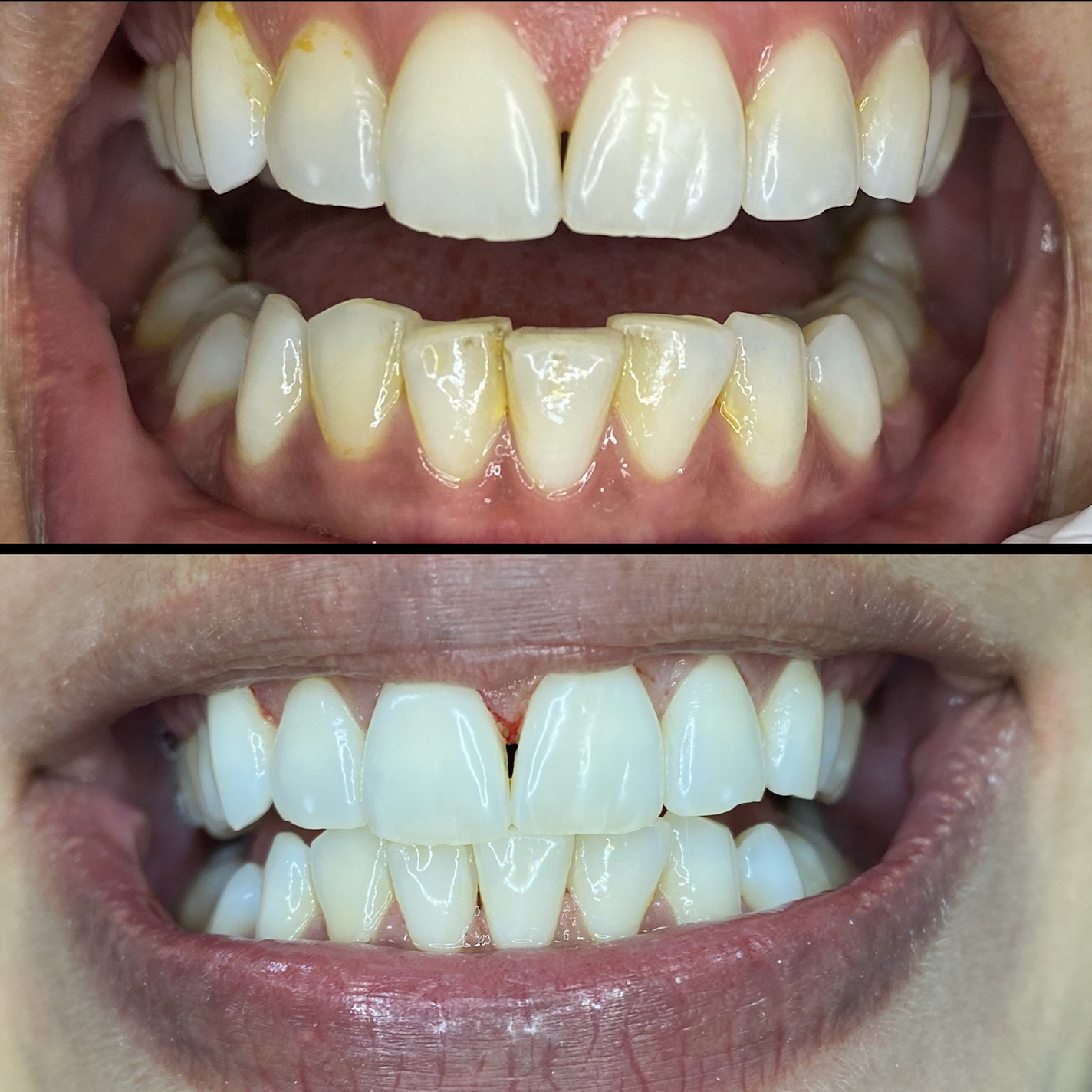 Persona australiana Obediente caja de cartón Limpieza Dental (en Costa Rica) Clínica Arco Dental Especialistas