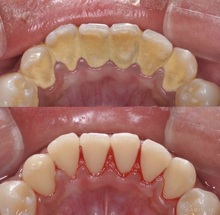 Dental (en Rica) Clínica Arco Dental
